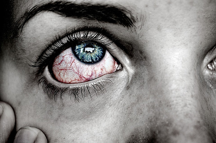 Eye Damage from UV Rays in Australia: Facts and Myths